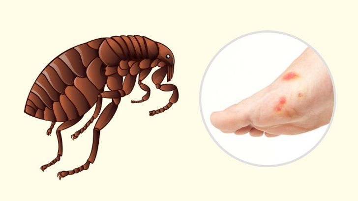 10 Bug Bites Anyone Should Be Able to Identify 8 Usa People 10 Bug Bites Anyone Should Be Able to Identify