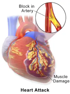 Heart Arteries