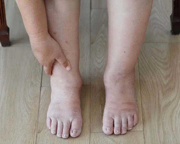 10 Signs Showing Something Is Wrong in Your Body